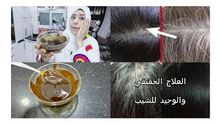 تعالو شوفو ازاى الشعر الابيض اختفى نهاائي من عند امى علاج الشيب  اكتشاف امى طايرة من الفرحة ازاى