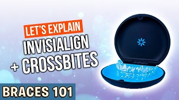 BRACES 101: Can INVISALIGN Fix CROSSBITES?! | Treatment Minute Talk!