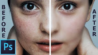 Face Retouching. How To Retouch Face in Photoshop. How to make  Glowing Skin Tone in Photoshop Hindi screenshot 5