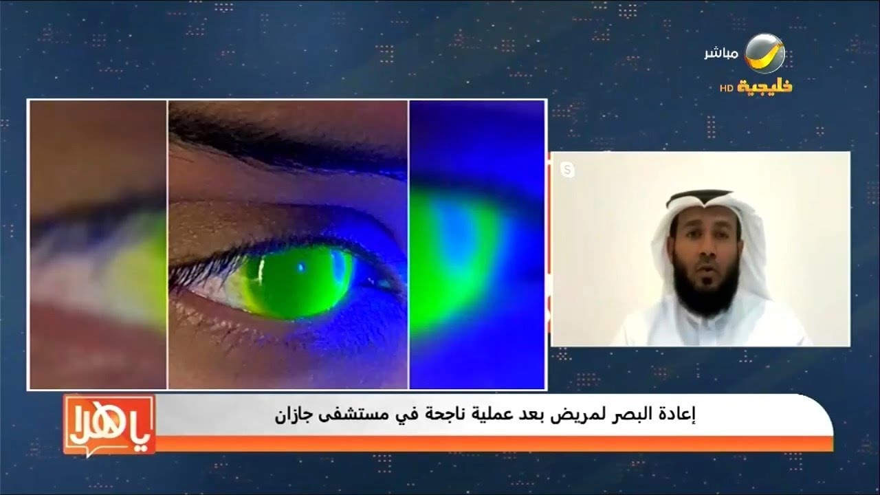 إعادة البصر لمريض بعد عملية ناجحة في مستشفى جازان