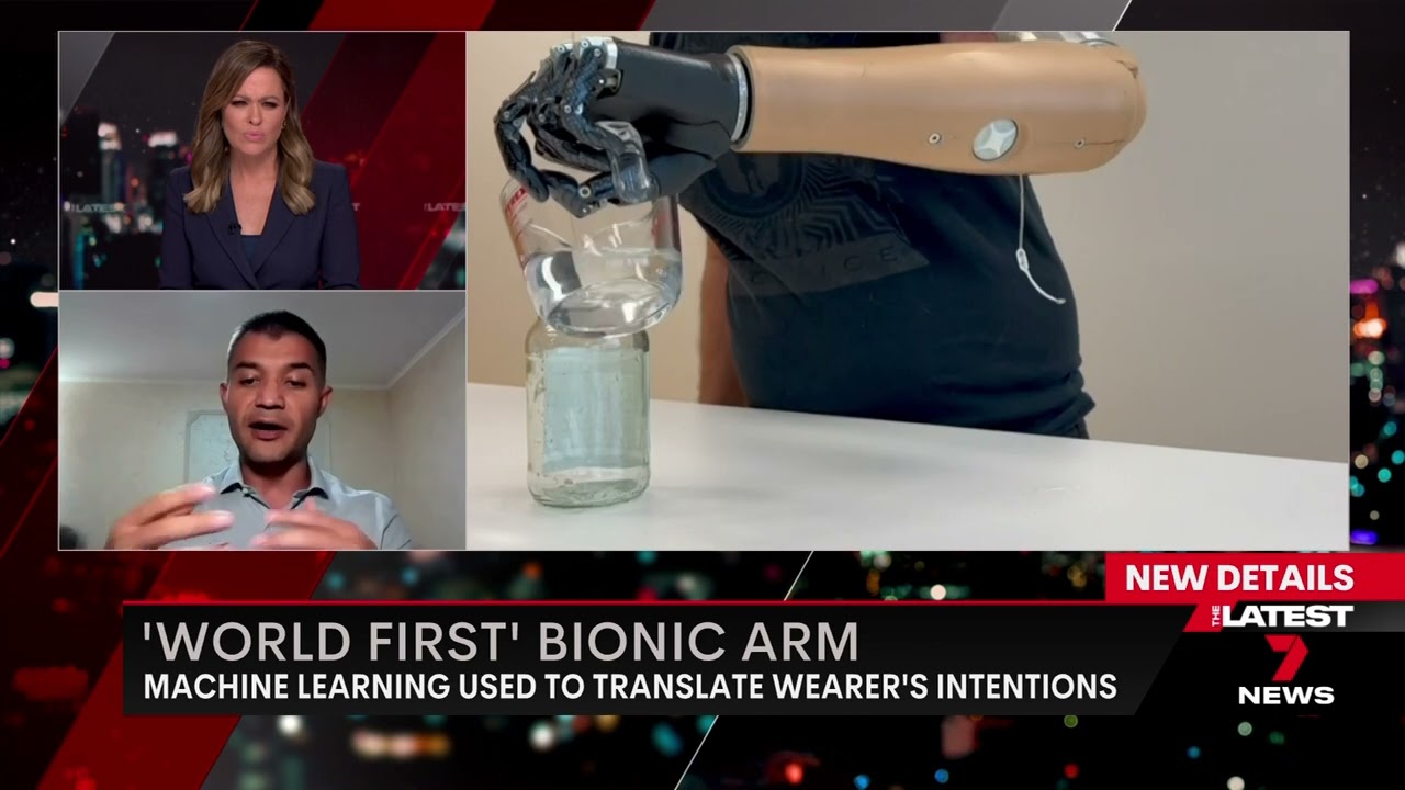 Groundbreaking' bionic arm that fuses with user's skeleton and