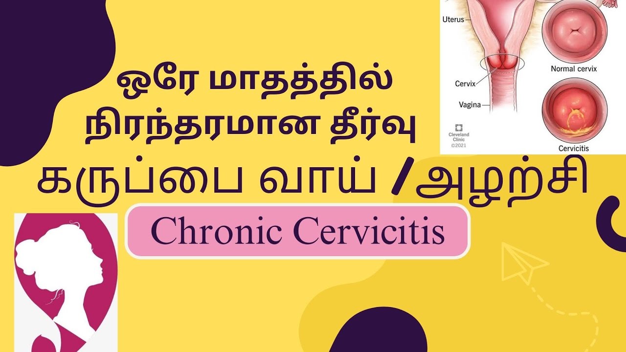 Chronic cervicitis#Permanent solution#Ayurveda💪#Dr.Meenakshi.V(B.A.M.S ...