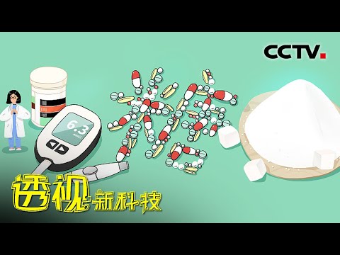 糖尿病能根治吗？快来看看最新技术是啥？20211114 |《透视新科技》CCTV科教