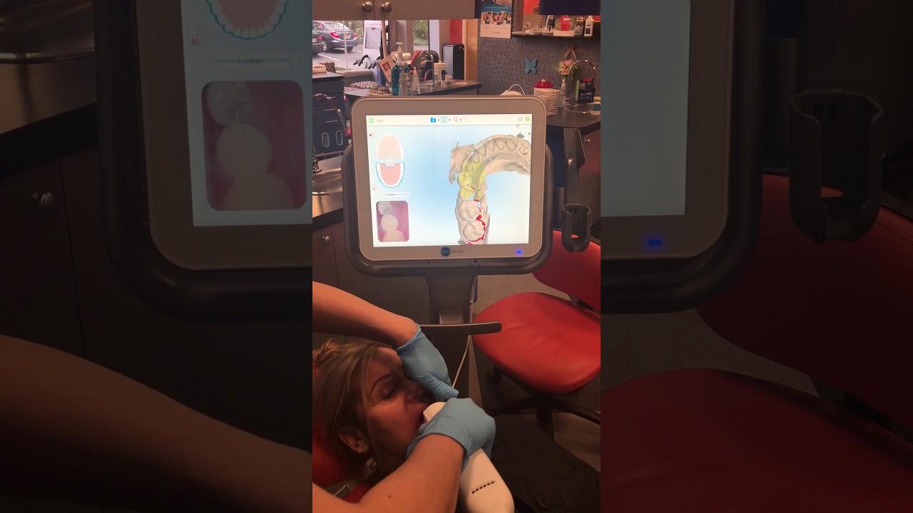 3D digital dentistry with iTero in NYC - No more impressions or goop