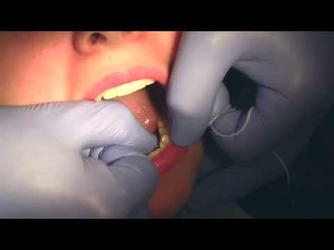 Wideo: Czy Gorzej Jest Pominąć Szczotkowanie Zębów Lub Nitkowanie Zębów?