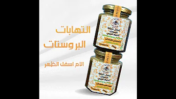 التركيبة الفعالة المستخلصة من عسل الزكوم الطبيعي الممزوج بالأعشاب 