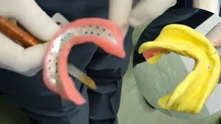 Mandibular Primary Impression For complete Edentulous patient