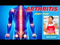 How to Stop Arthritis Pain