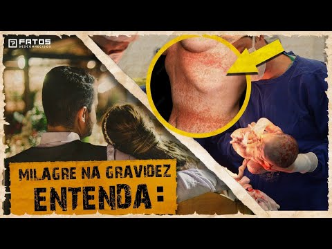 Mulher com doença de Darier-White faz o inimaginável para que o filho viesse ao mundo saudável