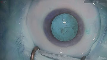 Ngenuity digital filters Lukan Mishev Live Stream