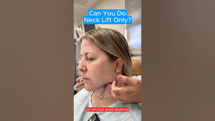 Can You Do Neck Lift Only? #facelift