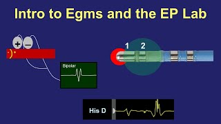 Intro to Intracardiac Electrograms & the EP Lab