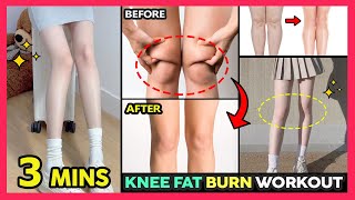 🔥3 MINS  BURN KNEE FAT WORKOUT | Lose Knee fat, Tighten Saggy Knees, Get Skinny Knees