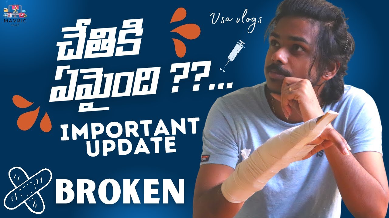 WHAT HAPPENED TO MY HAND ??@VSAVLOGS YOUR QUESTIONS ANSWERED...#telugu #teluguvlogs #vsavlogs #duke