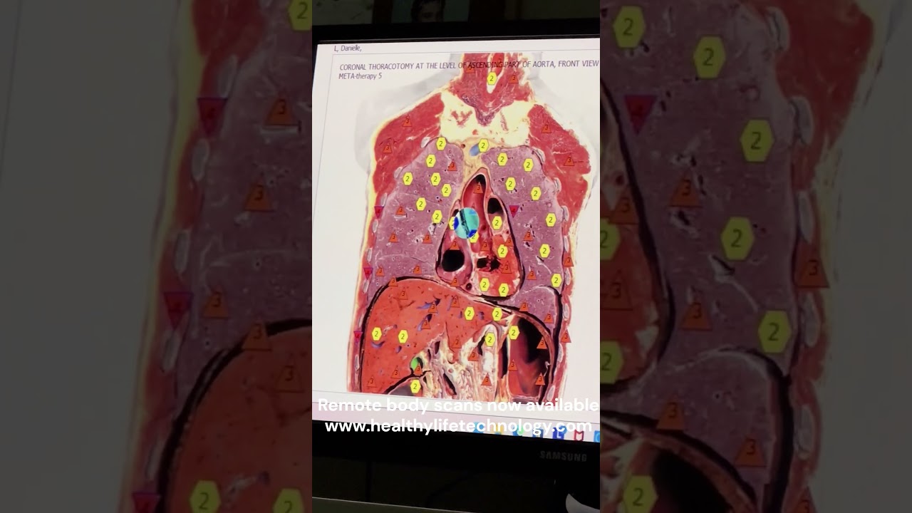 Посмотрите сеанс сканирования тела и корректирующих частот от Даниэль на конференции USA Med Bed ...