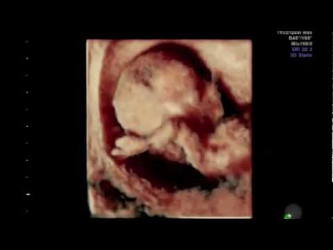 13 Settimane di gravidanza 3D