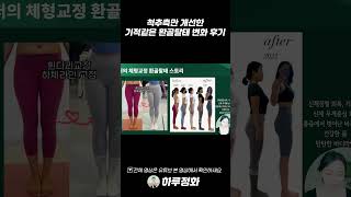 척추측만 진짜 고칠 수 있을까? 성인 척추측만 체형교정 후기 #척추측만증 #snpe #척추교정