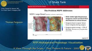RFPi Multispectral Physiologic Visualization