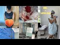 BBL PRE OP, SURGERY DAY, TIPS *must watch* + BODY REVEAL | Dr. Williams | 305 Plastic Surgery