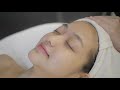 Jean Yip Aesthetics - Lumixyl GLOW Facial Management