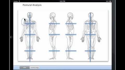 Medical clinical note drawing - Free iPad EHR | drchrono
