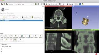 BIOE306 3DSlicer tutorial