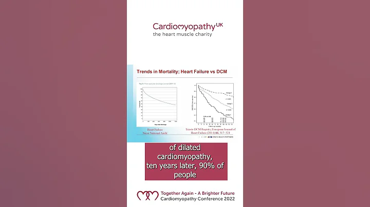 Dilated cardiomyopathy prognosis - DayDayNews