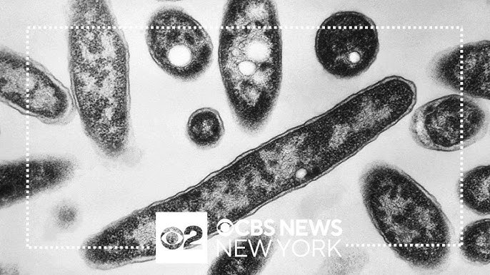 2 Cases Of Legionnaires Disease Reported In Brooklyn