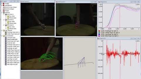 Hand Movement Analysis 3D with Simi Motion