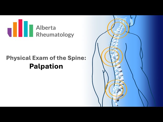 Rheumatology BACK exam Part 4: Palpation - YouTube