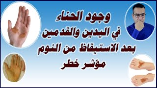 احذرو  وجود الحناء على اليدين والقدمين بعد الاستيقاظ من النوم مؤشر خطر