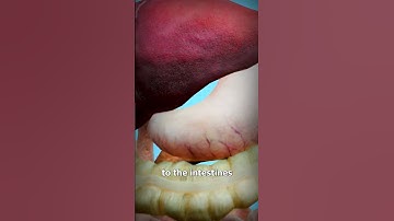Thumbnail of How Food Turns Into Poop😨