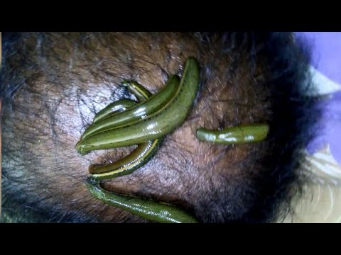 हिन्दू धर्म के वेद में है गंजेपन का इलाज