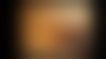 Bleeding Duodenal bleeding after ERCP (Ovesco OTSC)