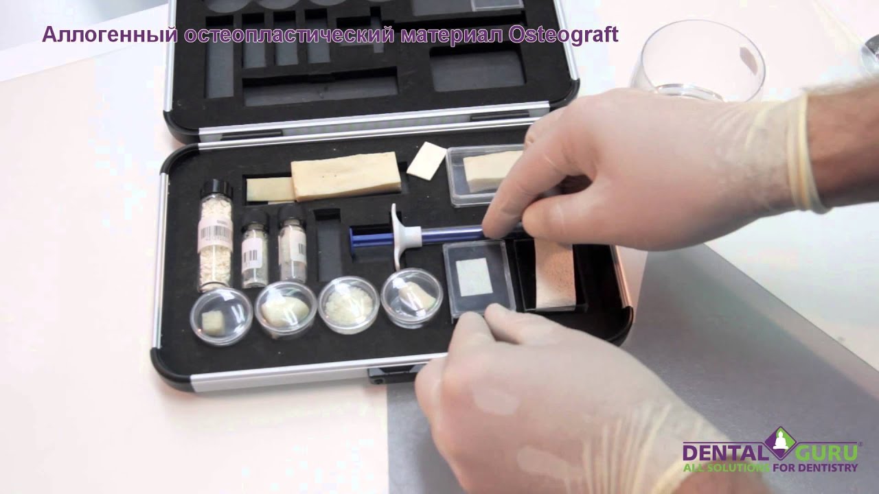 Описание аллопластического материала Osteograft