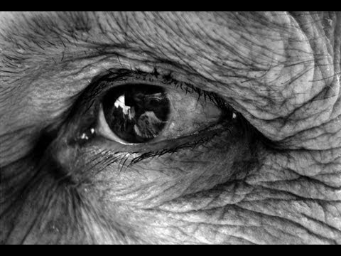 The Ageing Eye - Professor William Ayliffe thumbnail