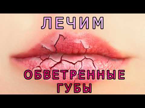 Как лечить обветренные губы? Быстро восстанавливаем кожу губ