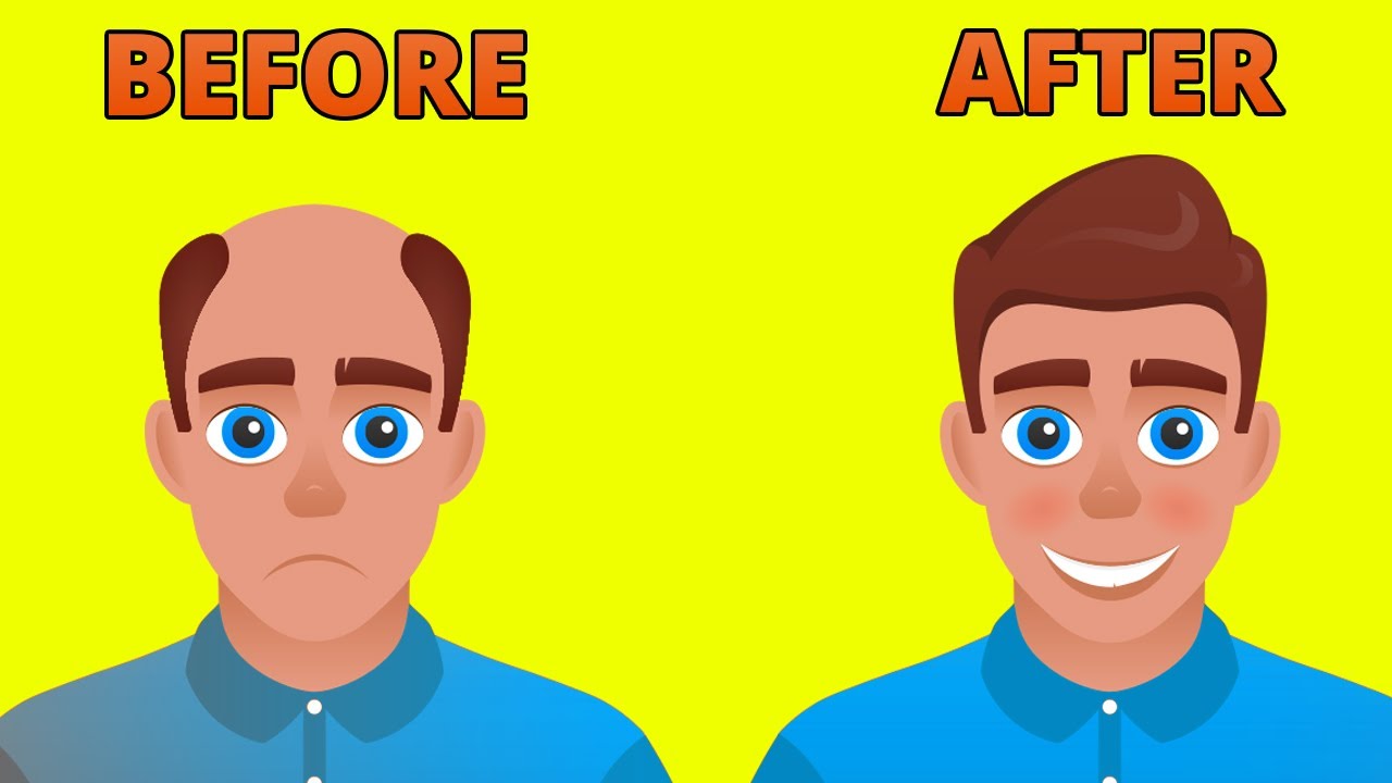 How To Grow Hair Faster and Stop Hair Loss Backed By Science 