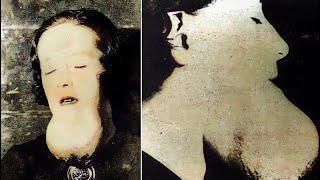 Twisted Human Experiments - Radiation
