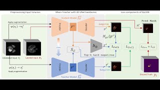 [CVPR 2025] DyCON: Dynamic Uncertainty-aware Consistency and Contrastive Learning for SSMIS