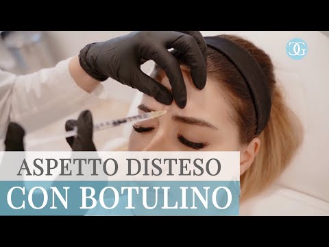 Video: Iniezioni di Botox fino a 40 anni: pro e contro