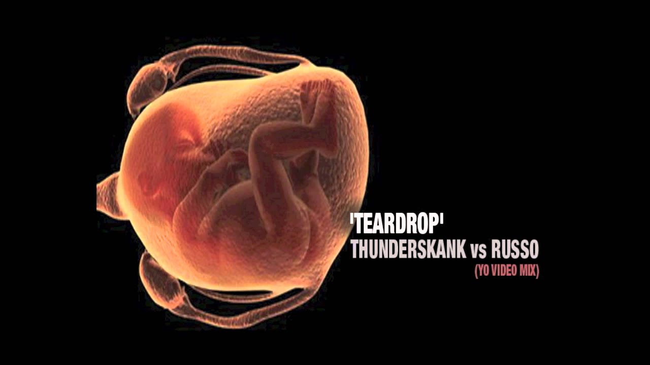 Thunderskank vs Russo 'Teardrop' (Yo Video mix)