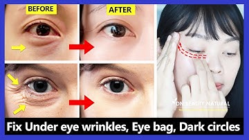 Only 6 mins!! Eye rejuvenation. Get rid of under eye wrinkles, dark circles, eye bags, Crow