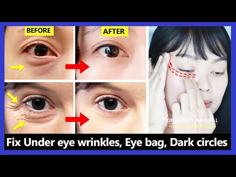 Video: ❶ How To Get Rid Of Wrinkles Under The Eyes