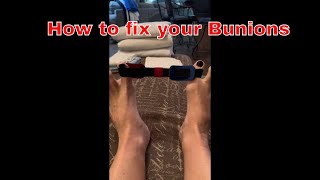 Bunion Corrector Strap, Bunion Relief Exercise Bunion Realignment Strap, Hallux Valgus Relief Aid