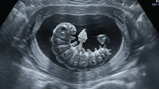 Fake ultrasound 