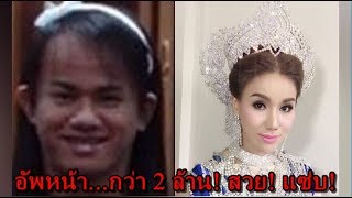 มหัศจรรย์มีดหมอ สาวสอง ช้ำรัก...โมหน้าเปลี่ยนชีวิต | เล่นใหญ่ จัดใหญ่ 3 ก.ค.60 [2/3]