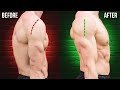 How I Fixed Rounded Shoulders Forever