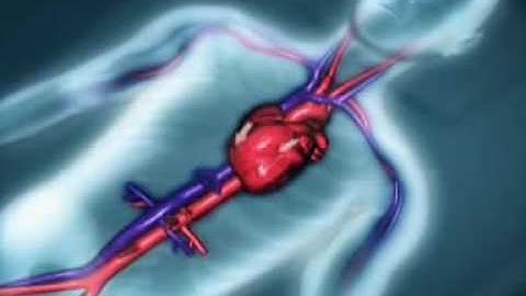 How EECP Therapy Works