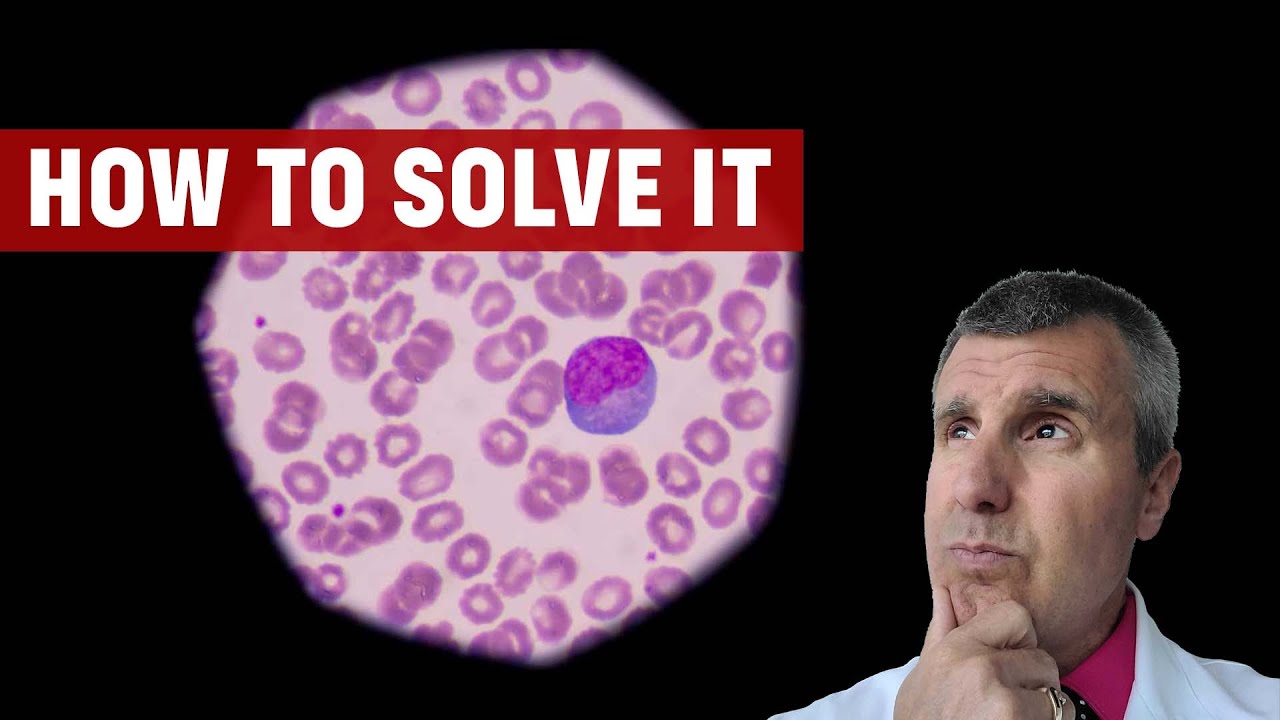 All About Lymphocytic Colitis video